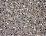 AKR1A1 Antibody in Immunohistochemistry (Paraffin) (IHC (P))