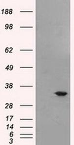 Livin Antibody in Western Blot (WB)