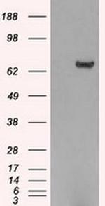 HDAC10 Antibody in Western Blot (WB)