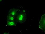 Livin Antibody in Immunocytochemistry (ICC/IF)