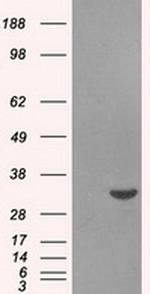 Livin Antibody in Western Blot (WB)