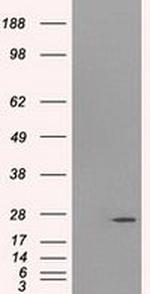 PSMD10 Antibody in Western Blot (WB)