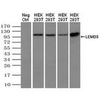 MAN1 Antibody in Western Blot (WB)