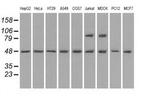 MAN1 Antibody in Western Blot (WB)