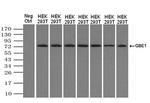 GBE1 Antibody in Western Blot (WB)