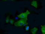 PFKFB4 Antibody in Immunocytochemistry (ICC/IF)