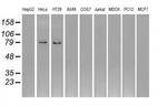 GBE1 Antibody in Western Blot (WB)