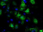 GBE1 Antibody in Immunocytochemistry (ICC/IF)