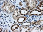 GBE1 Antibody in Immunohistochemistry (Paraffin) (IHC (P))