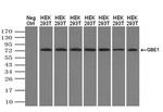 GBE1 Antibody in Western Blot (WB)