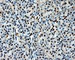 LOX Antibody in Immunohistochemistry (Paraffin) (IHC (P))