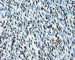 LOX Antibody in Immunohistochemistry (Paraffin) (IHC (P))