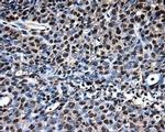 LOX Antibody in Immunohistochemistry (Paraffin) (IHC (P))