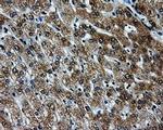 PKMYT1 Antibody in Immunohistochemistry (Paraffin) (IHC (P))