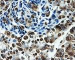 PKMYT1 Antibody in Immunohistochemistry (Paraffin) (IHC (P))