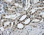 PKMYT1 Antibody in Immunohistochemistry (Paraffin) (IHC (P))