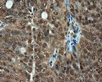 PSMC3 Antibody in Immunohistochemistry (Paraffin) (IHC (P))