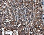 IFIT1 Antibody in Immunohistochemistry (Paraffin) (IHC (P))