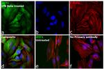 IFIT1 Antibody