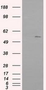 IFIT1 Antibody in Western Blot (WB)