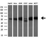 Annexin A11 Antibody in Western Blot (WB)