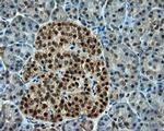 CUGBP1 Antibody in Immunohistochemistry (Paraffin) (IHC (P))