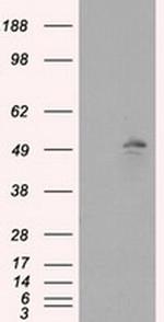 KIAA1609 Antibody in Western Blot (WB)