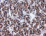 Serine racemase Antibody in Immunohistochemistry (Paraffin) (IHC (P))