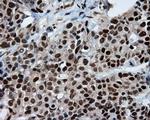 SIL1 Antibody in Immunohistochemistry (Paraffin) (IHC (P))