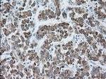 RF1ML Antibody in Immunohistochemistry (Paraffin) (IHC (P))