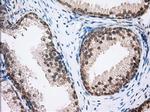 RF1ML Antibody in Immunohistochemistry (Paraffin) (IHC (P))