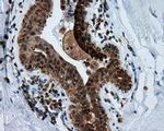 RF1ML Antibody in Immunohistochemistry (Paraffin) (IHC (P))