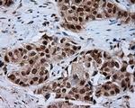 NPR3 Antibody in Immunohistochemistry (Paraffin) (IHC (P))