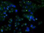 RDH11 Antibody in Immunocytochemistry (ICC/IF)