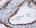 SHC Antibody in Immunohistochemistry (Paraffin) (IHC (P))