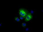 ALDH3A1 Antibody in Immunocytochemistry (ICC/IF)