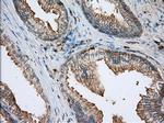 ALDH3A1 Antibody in Immunohistochemistry (Paraffin) (IHC (P))