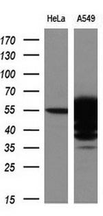 ALDH3A1 Antibody in Western Blot (WB)