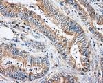 RhoGDI Antibody in Immunohistochemistry (Paraffin) (IHC (P))