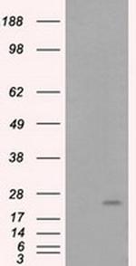 RhoGDI Antibody in Western Blot (WB)