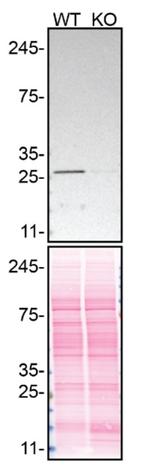 RhoGDI Antibody