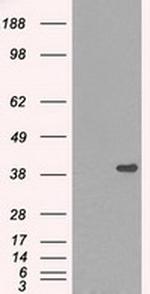 DNTTIP1 Antibody in Western Blot (WB)