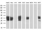 DNTTIP1 Antibody in Western Blot (WB)