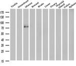 H-cadherin Antibody in Western Blot (WB)