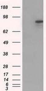 H-cadherin Antibody in Western Blot (WB)