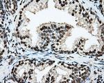 BMAL1 Antibody in Immunohistochemistry (Paraffin) (IHC (P))