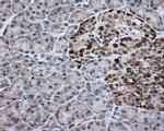 ACSBG1 Antibody in Immunohistochemistry (Paraffin) (IHC (P))