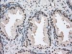 UAP56 Antibody in Immunohistochemistry (Paraffin) (IHC (P))