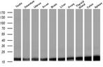 Profilin 1 Antibody in Western Blot (WB)