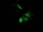 ACAT2 Antibody in Immunocytochemistry (ICC/IF)